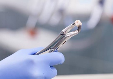 Wisdom tooth in forceps